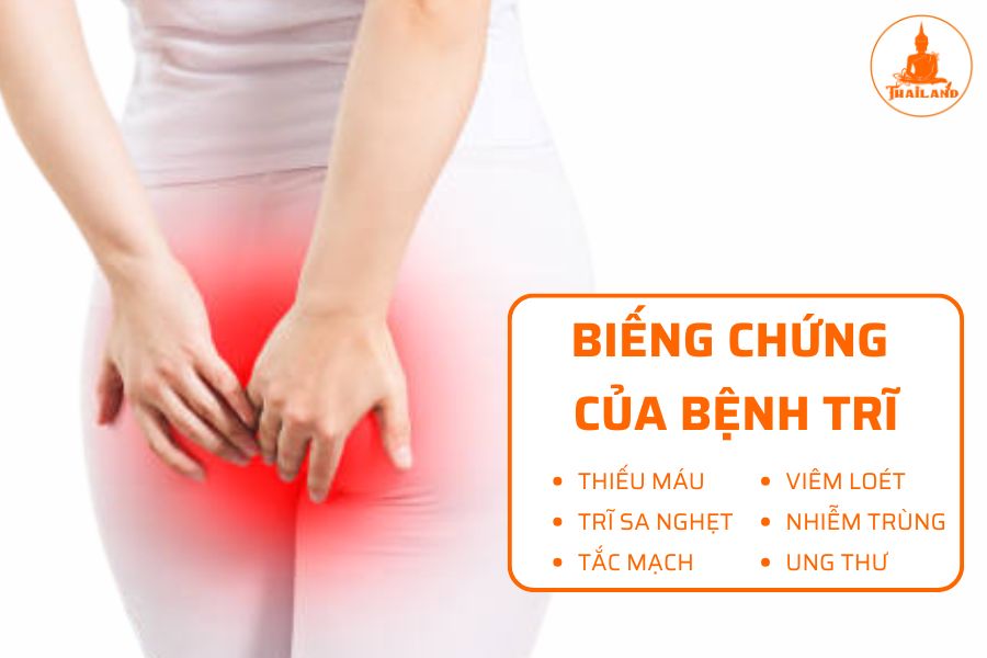 Biến chứng của bệnh trĩ