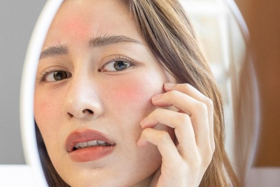 Da tổn thương vì kem trộn phải làm sao?