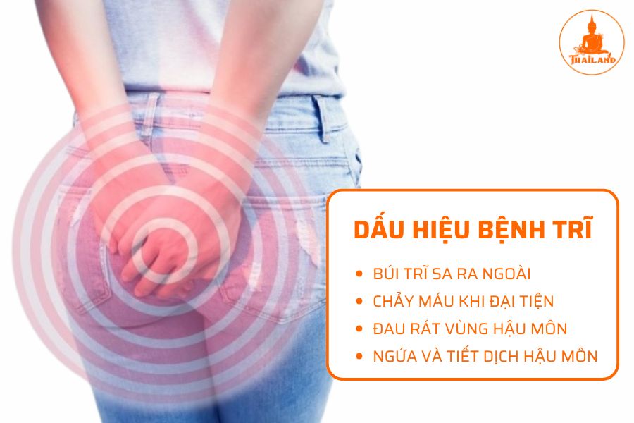 Dấu hiệu của bệnh trĩ