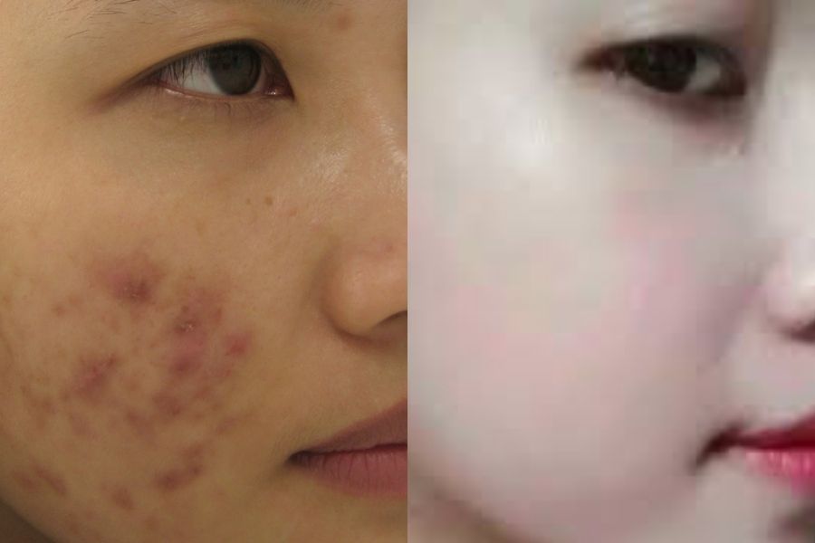Làm sao để biết mình đã dùng kem trộn