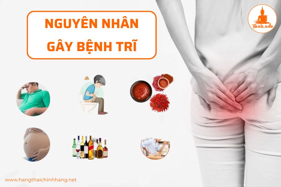 Nguyên nhân gây bệnh trĩ
