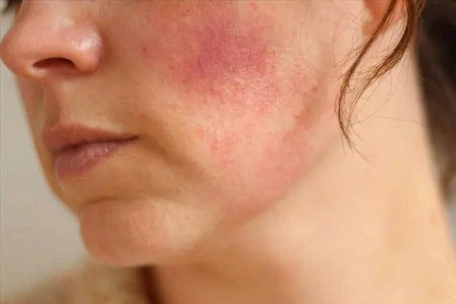 Tác hại của kem trộn