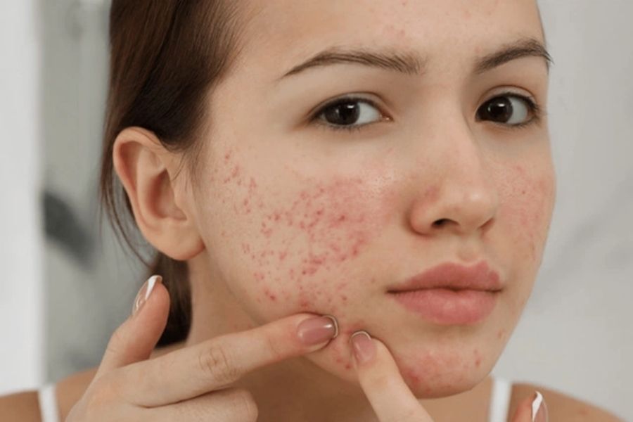 Tác hại của kem trộn
