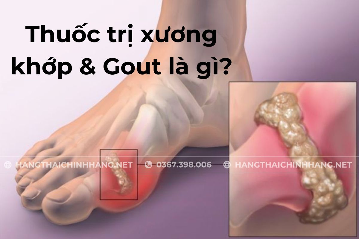 thuốc trị xương khớp & gout là gì