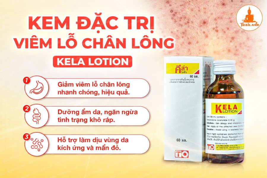 Công dụng của Kela Lotion