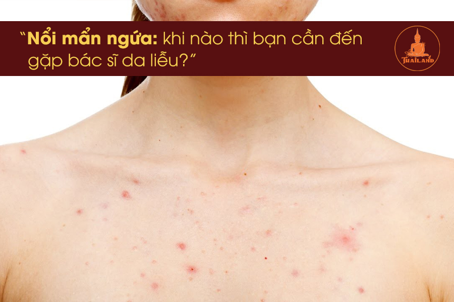 Biểu hiện nguy hiểm của da bị nổi mẩn ngứa