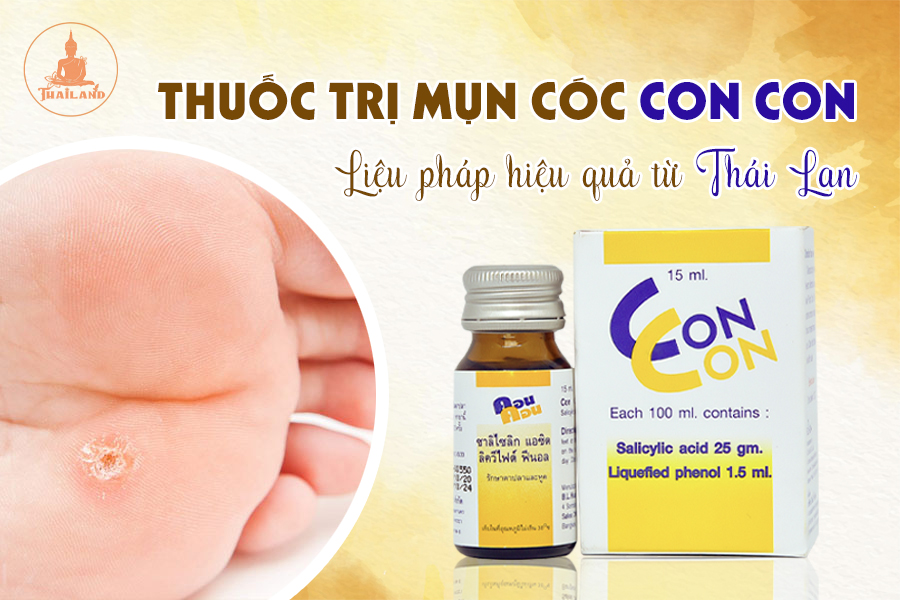 Công dụng thuốc trị mụn cóc Con Con 15ml Thái Lan