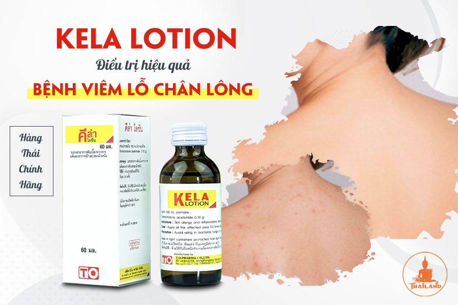 Công dụng nổi bật của Kela lotion trị viêm nang lông