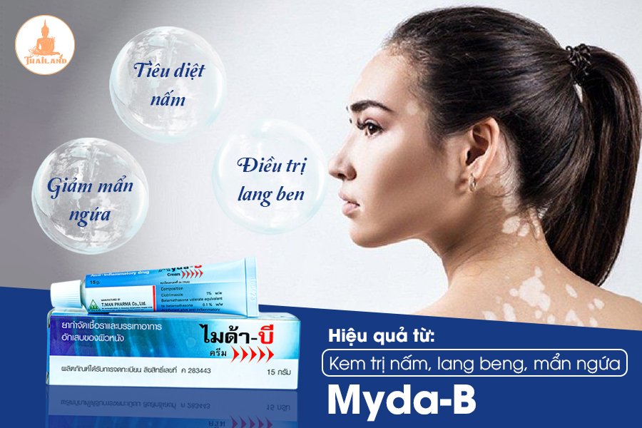 Công dụng kem trị lang ben Myda-B Cream