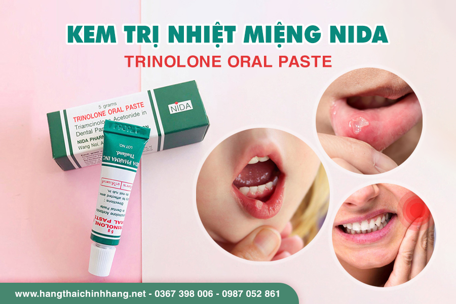 Công dụng thuốc trị nhiệt miệng Nida Trinolone Oral Paste Thái Lan