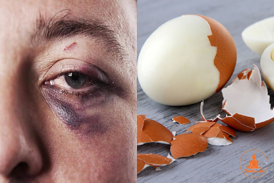 Lăn trứng gà giúp đánh tan máu bầm ở mắt an toàn
